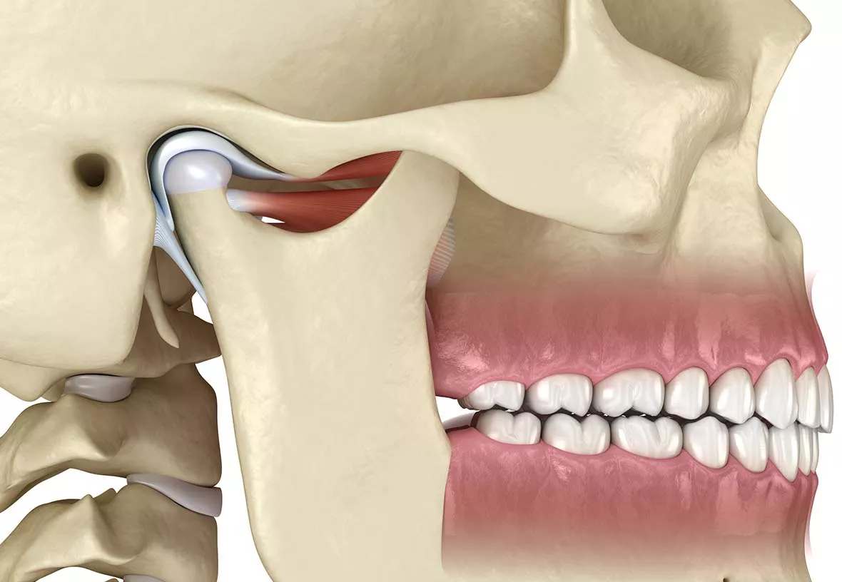 tmj treatment in Whitby