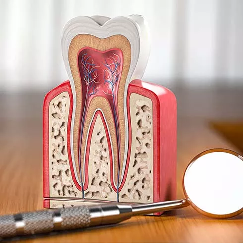 Endodontics in Whitby