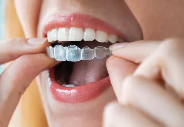 Orthodontics & Invisalign® in Whitby