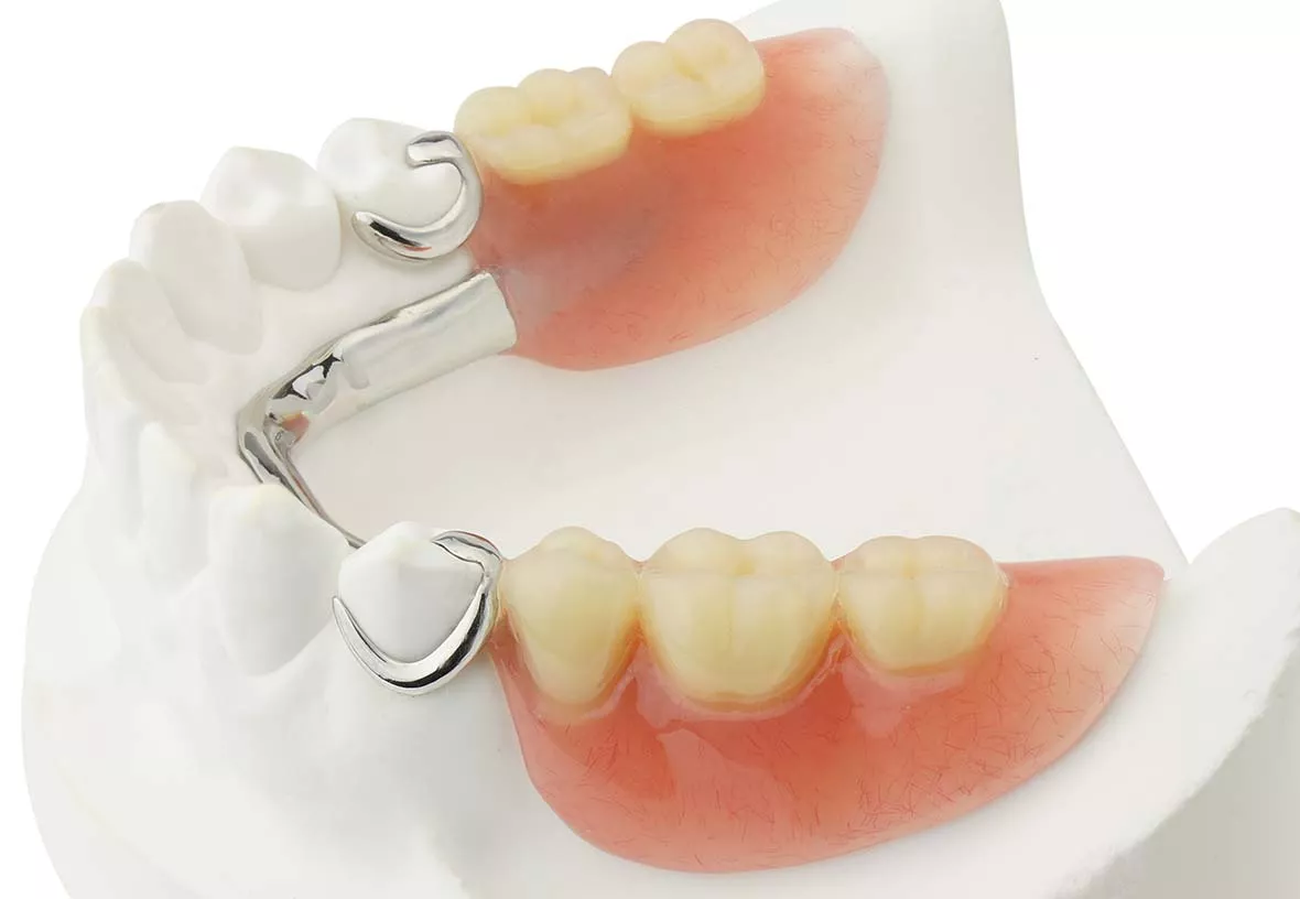 partial dentures